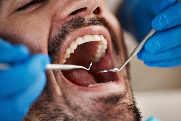 Best Emergency Treatment for Dental Infections or Abscesses in Clarkson Valley, MO